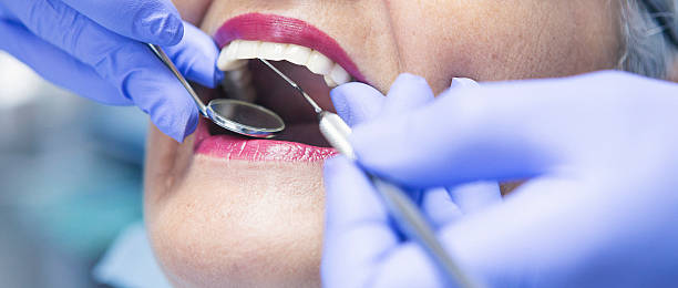 Best Emergency Tooth Extraction in Stacy, MN